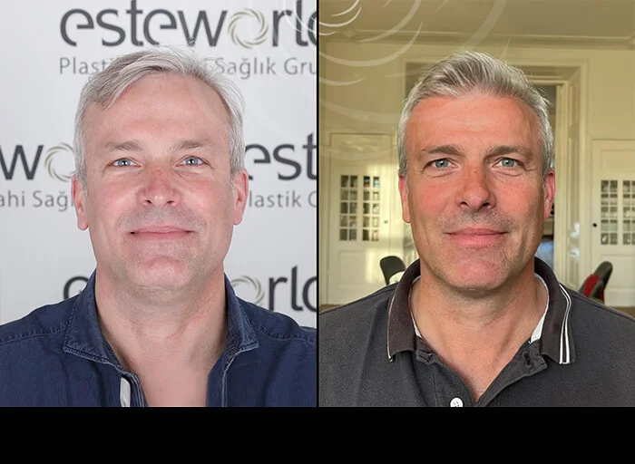 hair-before-after13