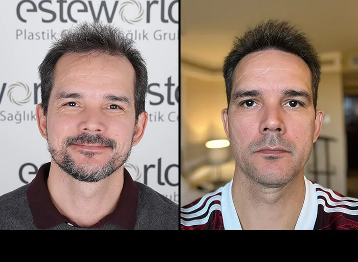 hair-before-after18