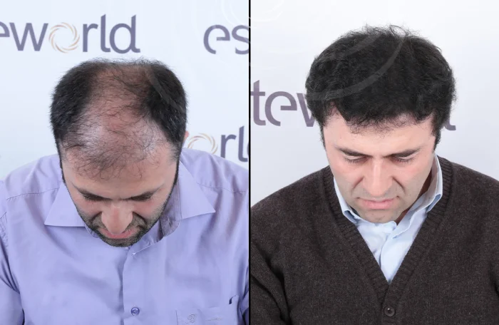 hair-before-after28