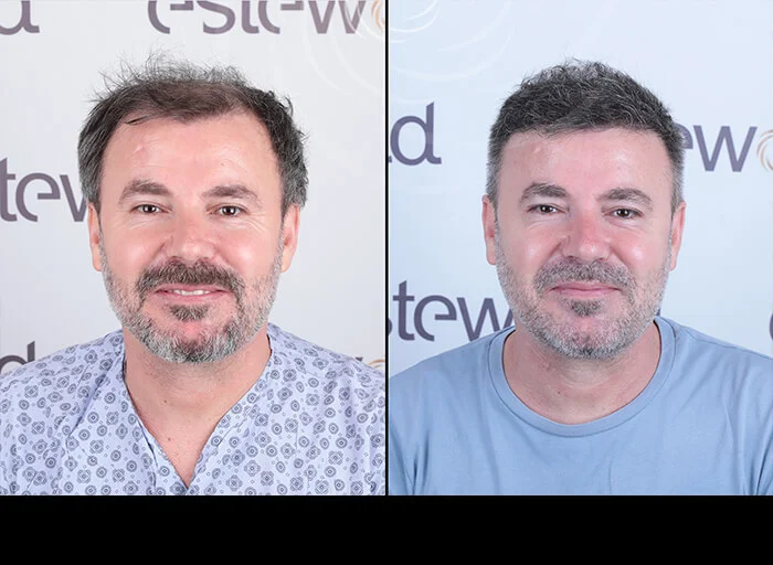 hair-before-after3