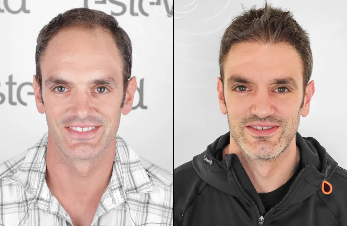 hair-before-after36