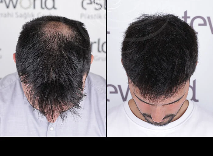 hair-before-after6
