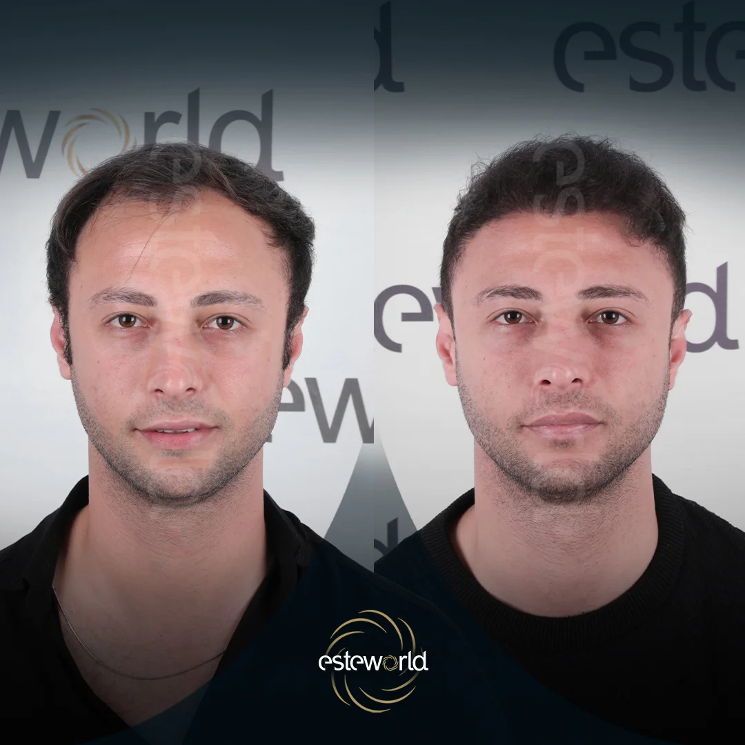 hair-before-after3