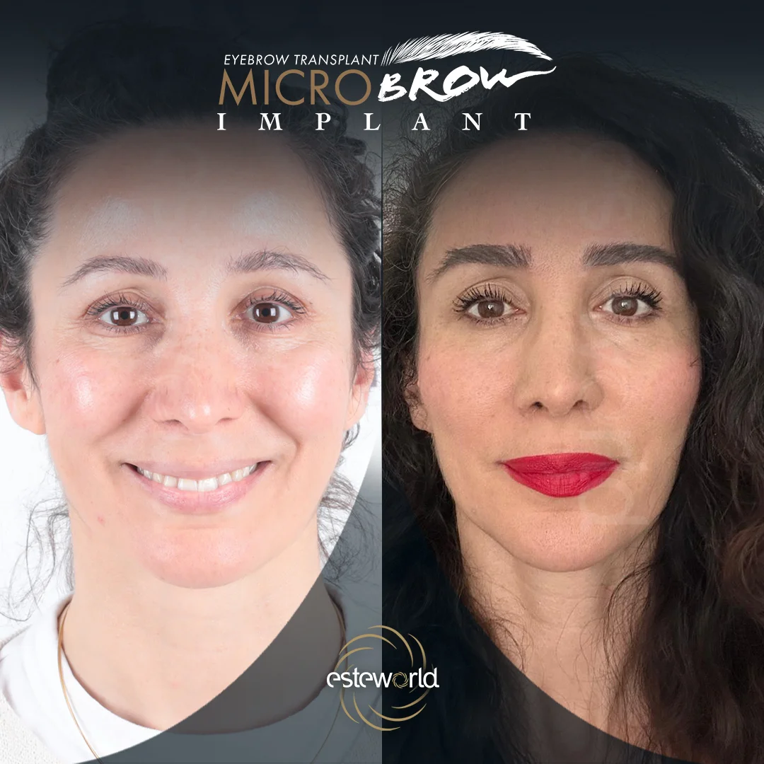 kas-before-after2