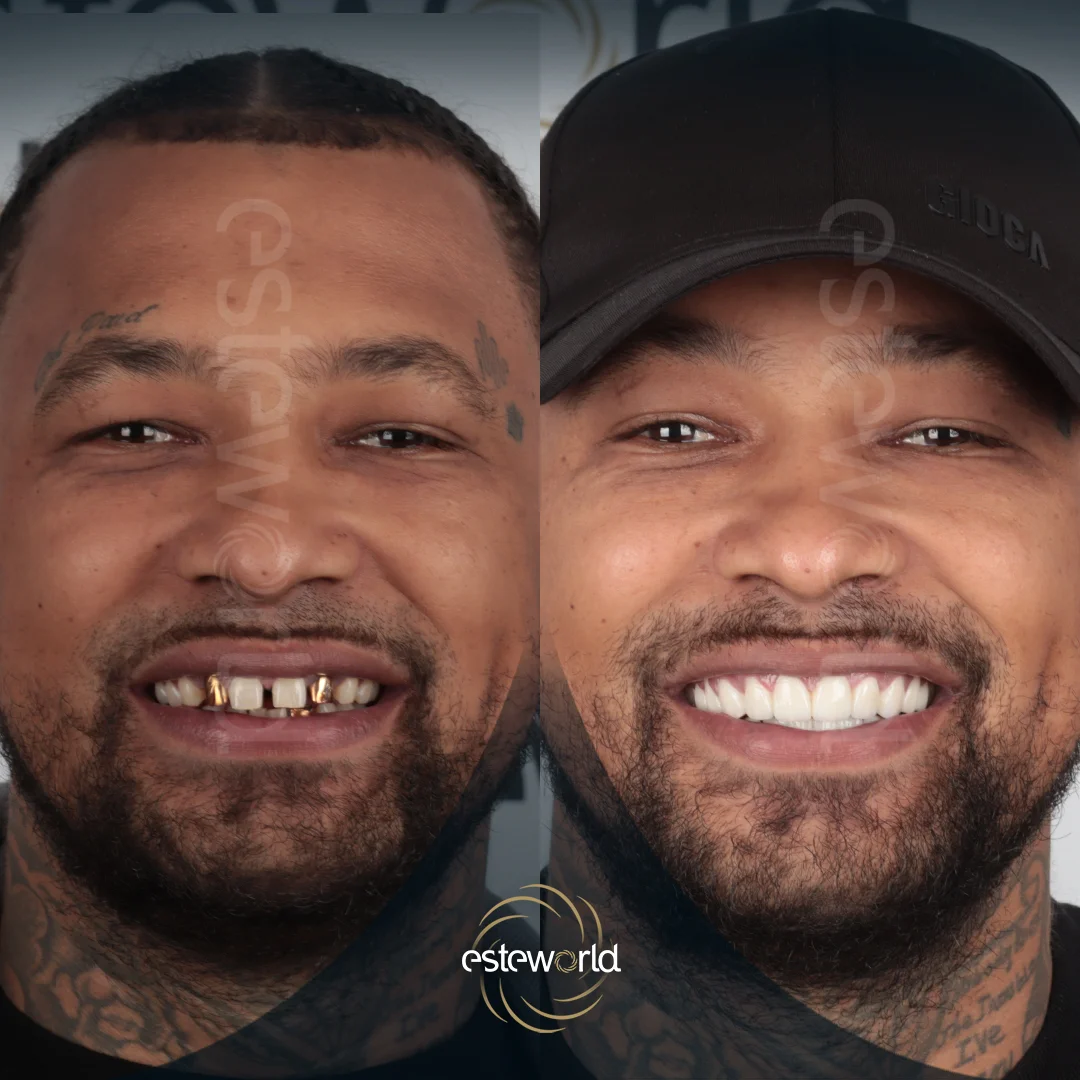 dental-before-after0