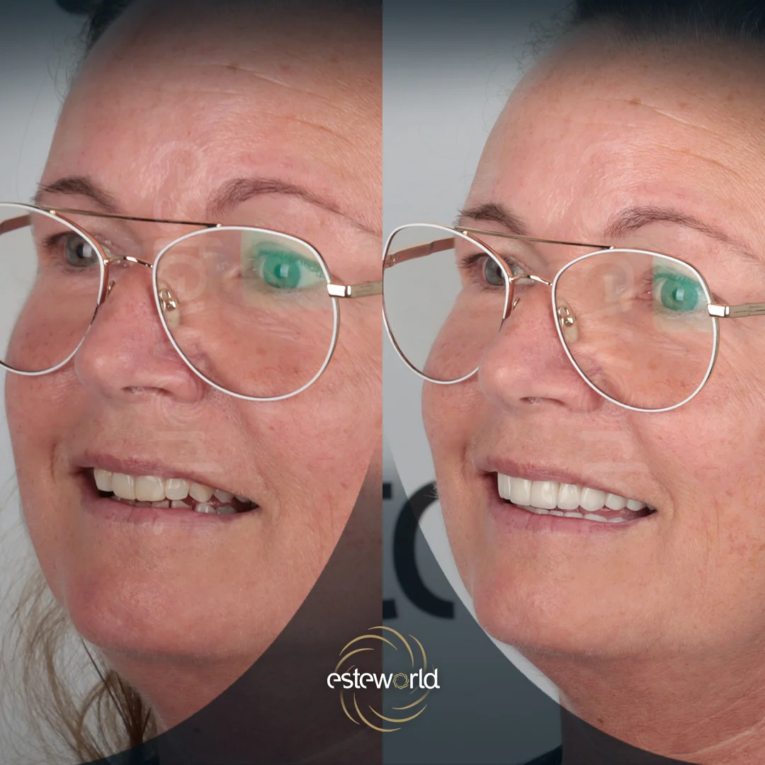 dental-before-after3