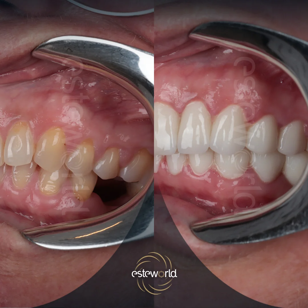 dental-before-after4