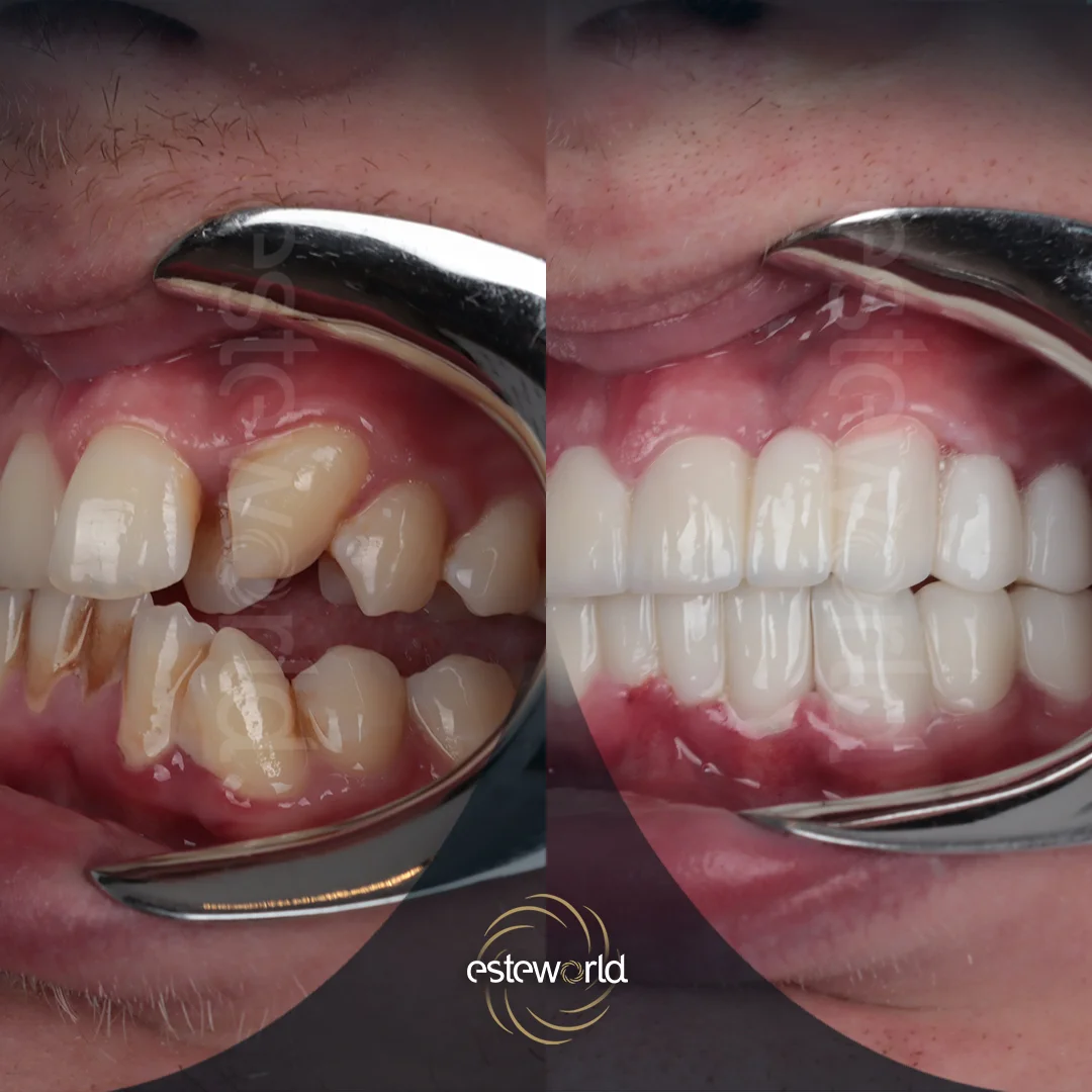 dental-before-after6