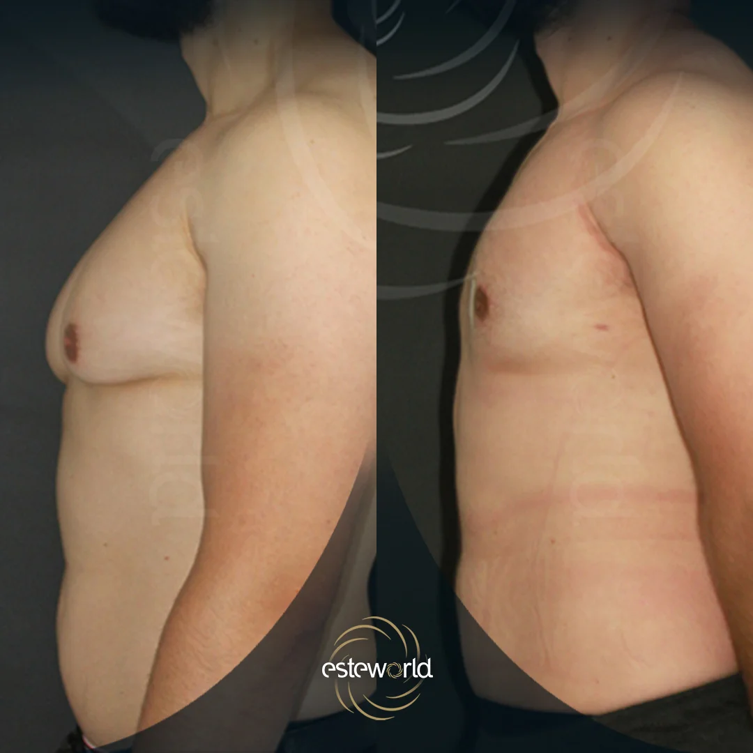 plastik-before-after6