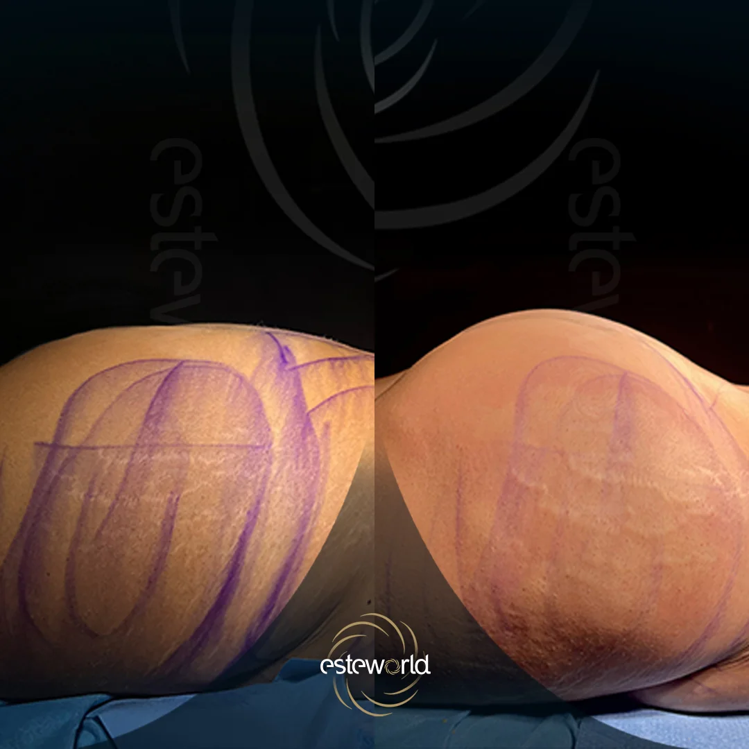 plastik-before-after7