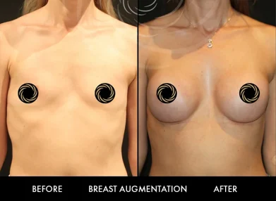 breast-surgery-cover0